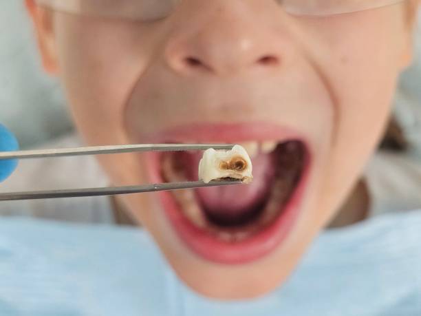 Best Cracked Tooth Emergency Dentist  in Worthington, KY