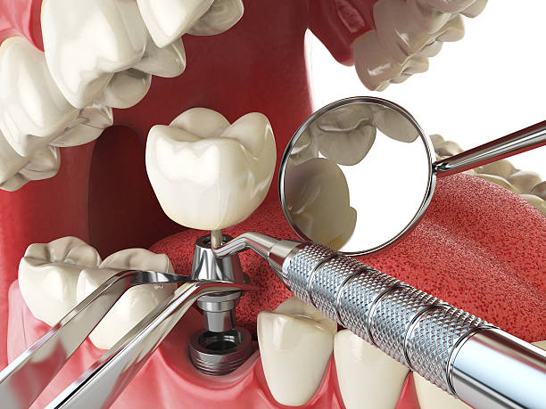 Best Emergency Tooth Extraction  in Worthington, KY